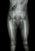 Película de rayos X del cuerpo normal del niño. foto