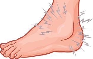 Human Foot Pain vector