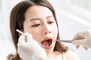 la mujer asiática está teniendo un examen dental de rutina en la clínica dental foto