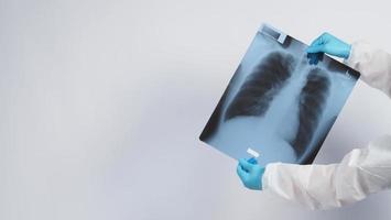 Lungs x-ray film in doctors hands photo