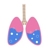 Pulmonary edema. Fluid in the respiratory organs. Bubbles in the lungs. Vector illustration isolated on white background.