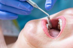 Primer plano de una paciente que tiene sus dientes examinados por un dentista especialista.
