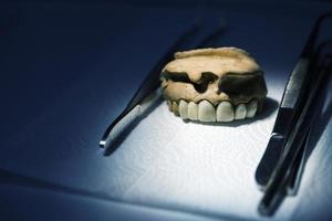 Placa dental de porcelana de circonio en la tienda del dentista