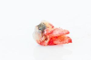 Extraction of decayed tooth on white background. photo