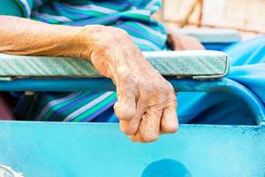 closeup hand of old man suffering from leprosy photo