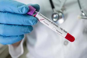 Positive blood infection sample in test tube for covid 19 coronavirus photo