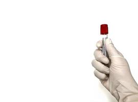 Hand wearing glove holding blood test tube on white background photo