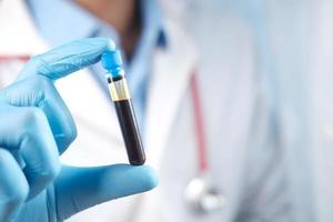 hand in blue medical gloves holding blood test tube photo