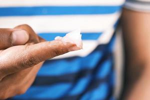 Close up of man hand using petroleum jelly photo