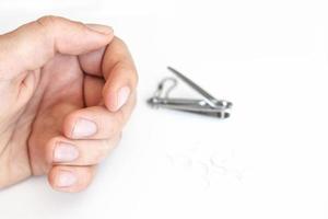 Trimmed nails of a young man photo