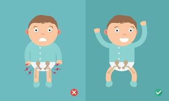 Best and worst positions child for prevention of hip dysplasia vector