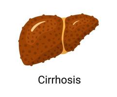 Liver cirrhosis isolated on white background. vector