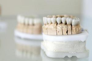placa de dientes de porcelana de circonio