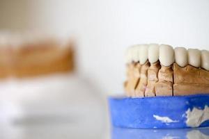 placa de dientes de porcelana de circonio foto