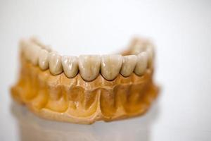 placa de dientes de porcelana de circonio