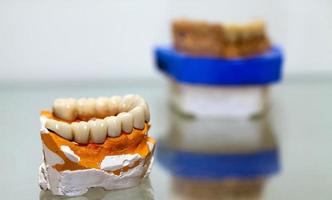 Zirconium Porcelain Tooth plate in Dentist Store photo