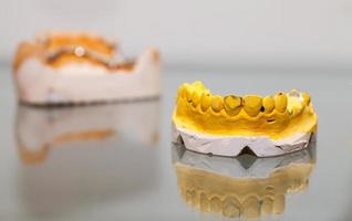 Zirconium Porcelain Tooth plate in Dentist Store photo