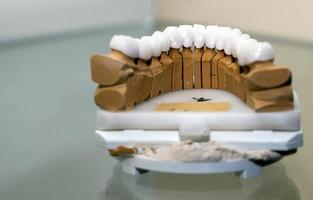 Zirconium Porcelain Tooth plate in Dentist Store photo