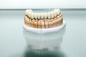 Zirconium Porcelain Tooth plate in Dentist Store photo