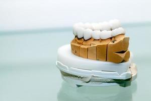 Zirconium Porcelain Tooth plate in Dentist Store photo