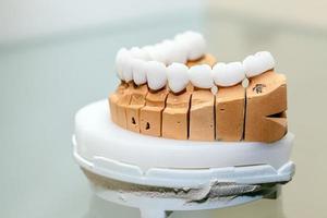 Zirconium Porcelain Tooth plate in Dentist Store photo