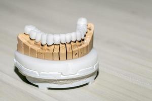 Zirconium Porcelain Tooth plate in Dentist Store photo