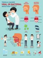 Tonsils caused viral or bacterial infection vector