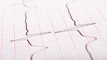 Heart rate on paper cardiogram closeup. photo