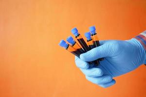 Mano en guantes médicos azules sosteniendo un tubo de ensayo de sangre foto