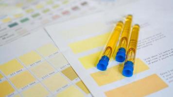 Urine tubes are placed on color charts. The concept of analyzes photo