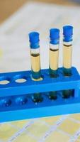 Test tubes with urine on medical color schemes. Concept of analyzes photo