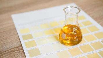 A flask with urine. Diagnostics by the color of urine photo