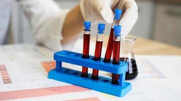 Hand of a scientific taking a blood sample tube from stand photo