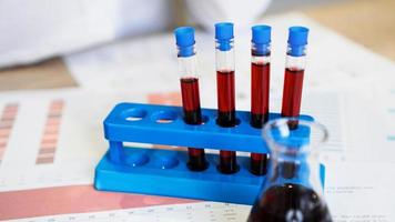 Test tubes on a stand and a flask with red blood on medical documents photo