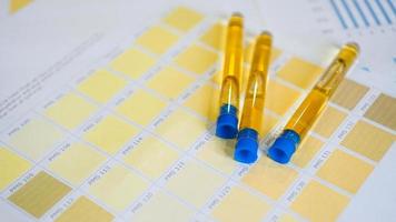 Urine tubes are placed on color charts photo