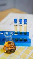 Flask and test tubes with urine on medical color schemes photo