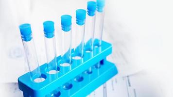 Test tubes on a blue stand against a blurred sheets with test results photo