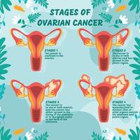 infografía de la etapa del cáncer de ovario vector