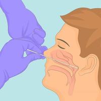 Taking sample swab from the nose and throat vector