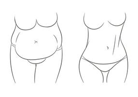 Thick and thin, overweight problems concept. Tummy before and after vector