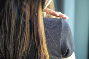 Rear view of woman having the dandruff on the shoulder photo