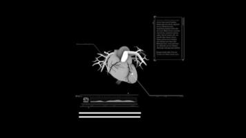 infographie animée concept recherche médicale video