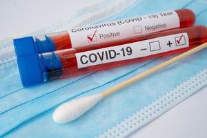 Tubo de análisis de sangre de muestra de virus covid19 o coronavirus en el laboratorio del hospital foto