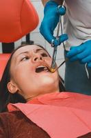 inyección con una jeringa carpule, el dentista inyecta al paciente. foto