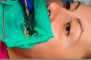 the doctor conducts sterile work on tooth restoration. photo