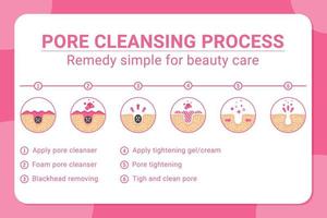 Vector banner 6 tips for blackheads removing and pore cleansing process. Acne or blackhead pore cleansing process with remedy simple for beauty care in isolated white background. Design for skincare