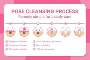 Vector banner 6 tips for blackheads removing and pore cleansing process. Acne or blackhead pore cleansing process with remedy simple for beauty care in isolated white background. Design for skincare