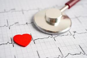 estetoscopio en electrocardiograma con corazón rojo, onda cardíaca, ataque cardíaco, informe de cardiograma. foto
