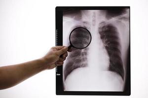 Doctor zoom X-ray, doctor revisando la película de rayos X de tórax en la sala hospita. foto