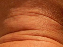 Human skin texture in various parts of the body photo